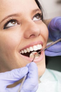 Tooth bonding or veneers for gaps in teeth