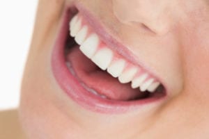 All about dental implants