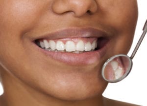 Prevent Complex Dental Concerns in Columbia MD