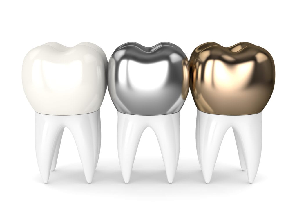 Types of Dental Crowns in Columbia, Maryland