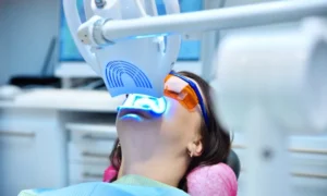 The Benefits of Professional Teeth Whitening in Columbia, MD